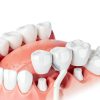GUM Proxabrush Interdental Brush Refills Model 614RQF MP Soft Bristles-3