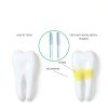 Interdental Brush Cowwell Betweens 2506 Small Tight Color Options-2